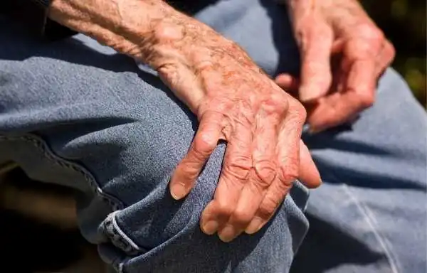 Arthritis Causes Symptoms and Treatment in Hindi