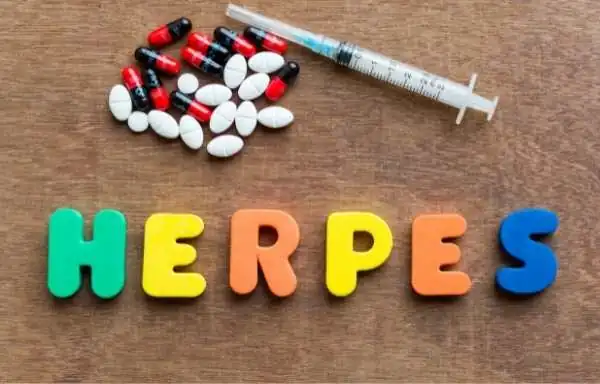 Herpes Medicines and Treatment in Hindi