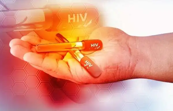 HIV AIDS Treatment in Hindi