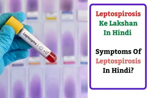 Leptospirosis Ke Lakshan In Hindi - Symptoms Of Leptospirosis In Hindi?