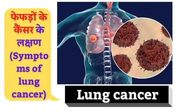 फेफड़ों के कैंसर के लक्षण (Symptoms of lung cancer):
