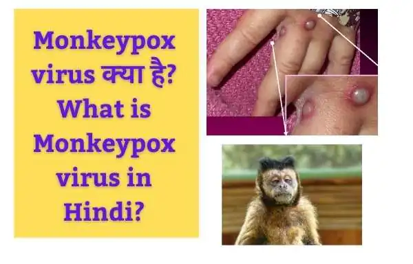 Monkeypox virus क्या है? | What is monkeypox virus in Hindi?