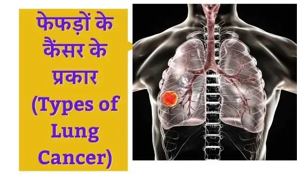 फेफड़ों के कैंसर के प्रकार (Types of Lung Cancer):