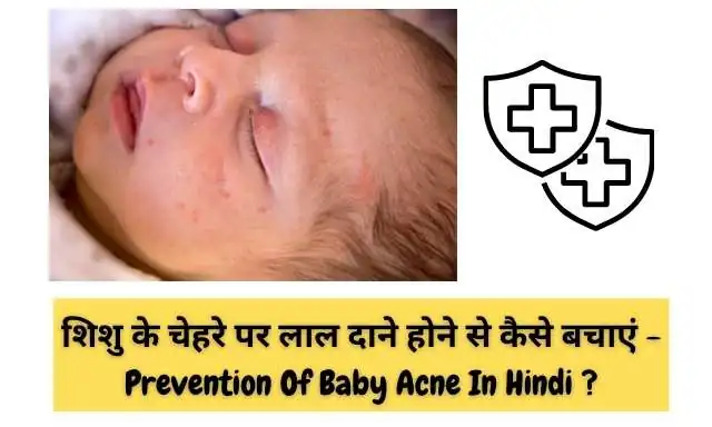 शिशु के चेहरे पर लाल दाने होने से कैसे बचाएं - Prevention Of Baby Acne In Hindi ?