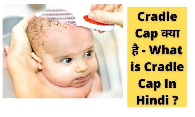 Cradle Cap Disease In Hindi 