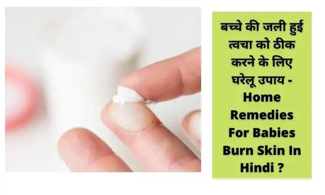 बच्चे की जली हुई त्वचा को ठीक करने के लिए घरेलू उपाय - Home Remedies For Babies Burn Skin In Hindi ?