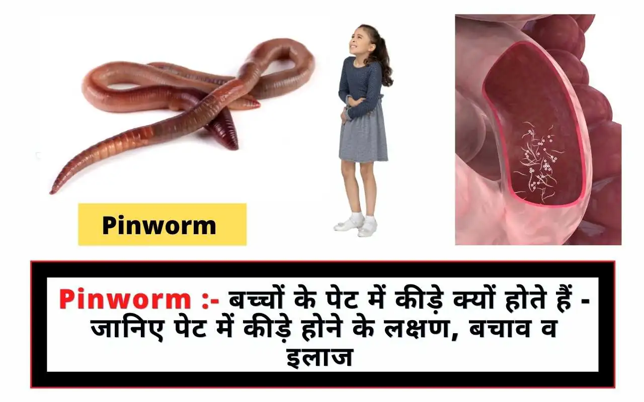 Pinworm :- बच्चों के पेट में कीड़े क्यों होते हैं - जानिए पेट में कीड़े होने के लक्षण, बचाव व इलाज ?What is Pinworm know its symptoms, causes and Best Treatments in Hindi